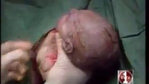 Видео ролик родов   второй этап  Посмотреть видео родов   второй этап