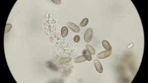 Чем питаются инфузории