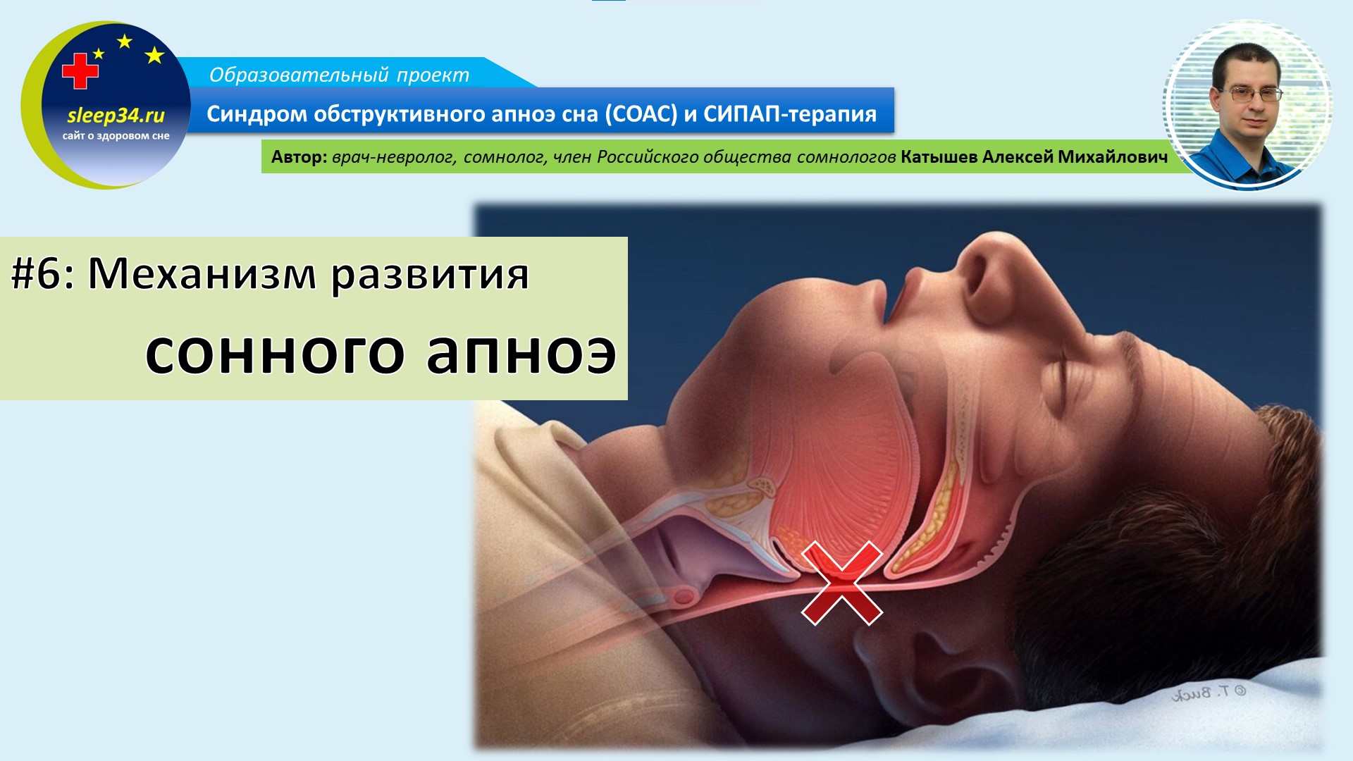 Во сне останавливаться. Синдром обструктивного апноэ сна. Сипап терапия. Синдром обструктивного апноэ сна лечение