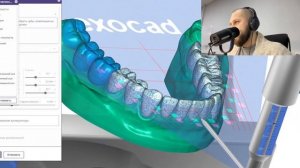 Wax up exocad разбор кейса. Exocad modelling