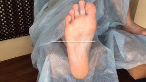 Эликсир для стоп - обработка гиперкератоза