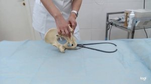 Тазоизмерение