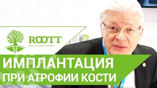 Кортикальная фиксация имплантов при атрофии костной ткани без наращивая кости