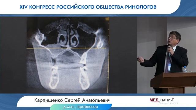 Сложные пазухи   трудные пациенты