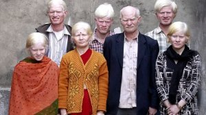 Кто такие альбиносы? Необычные люди и интересные факты о их жизни..