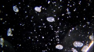 Вода из под цветов под микроскопом