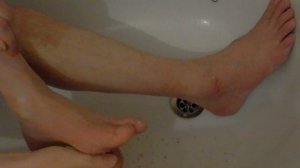 Как избавиться от трещин на коже ступней ног