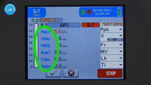 Аппарат ИВЛ LUNA BELT