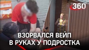 Бабушка дала прикурить: вейп взорвался в руках у подростка из Химок. Порвало нос, рот и пальцы