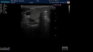 Пример сдачи практических навыков на станции "Ультразвуковое исследование поверхностных органов"