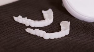HONEST REVIEW: Snap-On Smile veneers