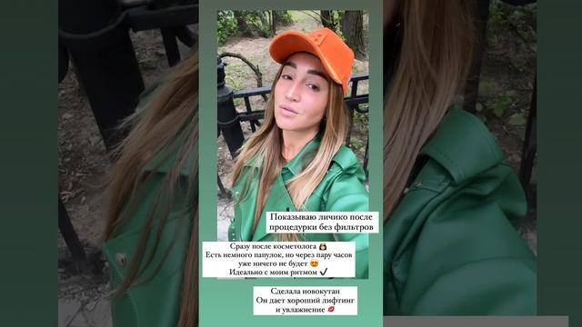 Ольга Бузова показала себя без макияжа и фильтров после похода к косметологу