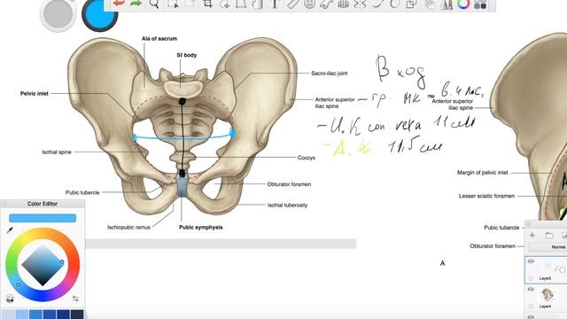 Анатомия таза человека 2 . Плоскость входа Размеры таза смотреть онлайн