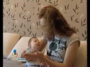 Полина Гайзатуллина (синдром Веста)