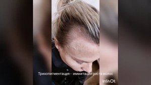 трихопигментация имитация роста  волос