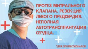 Протез митрального клапана, резекция левого предсердия. Неполная аутотрансплантация сердца.