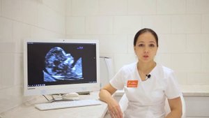 Гипоплазия носовой кости