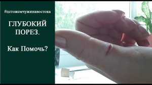 Глубокий порез. Как помочь? Здоровье с ЦСТО "Жемчужина Востока".