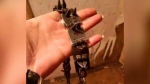 Почки, скорее всего, отбиты, потому что пинали...