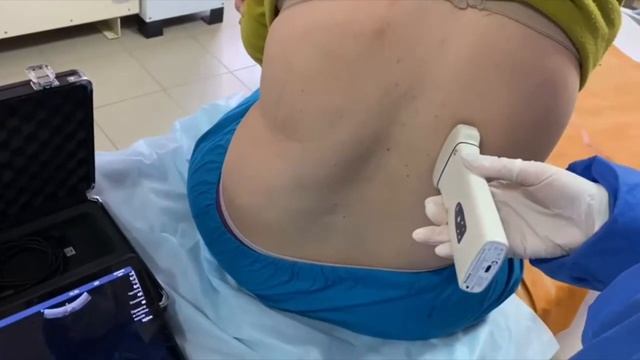 Экстренное ультразвуковое исследование травм перед МРТ/КТ с помощью Delta 8 смотреть онлайн