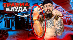 ТРАВМА ВИКТОРА БЛУДА