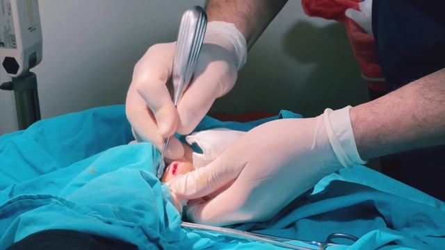 Якиним сол АЗОБ кашидум Кати хами нохун вросший ноготь на БОЛЬШОМ пальце ноги смотреть онлайн