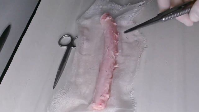 Сосудистый шов. Анастомоз конец в конец. Заседание СНК 28.03.23 смотреть онлайн