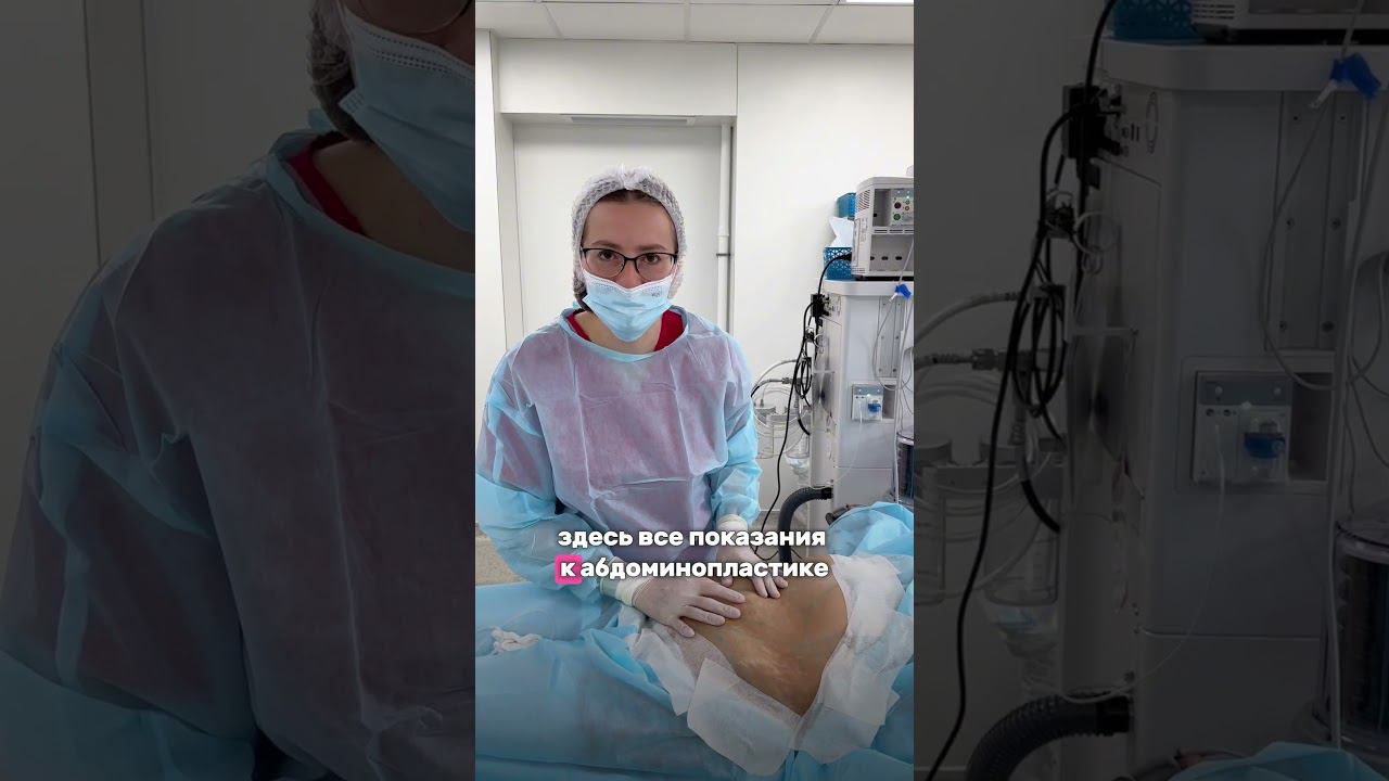 Бинарная липосакция сложного живота #shorts #врач #липосакцияживота #липосакция #операция