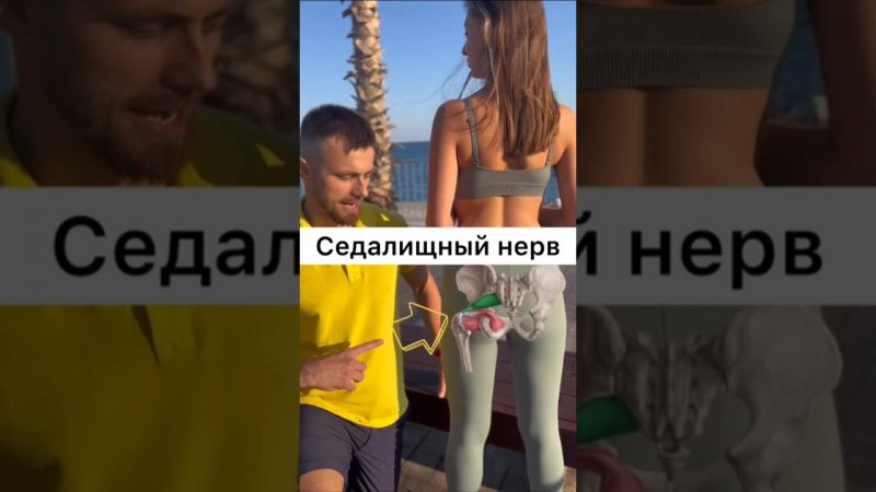 ✅ Что делать при боли в седалищном нерве? #shorts