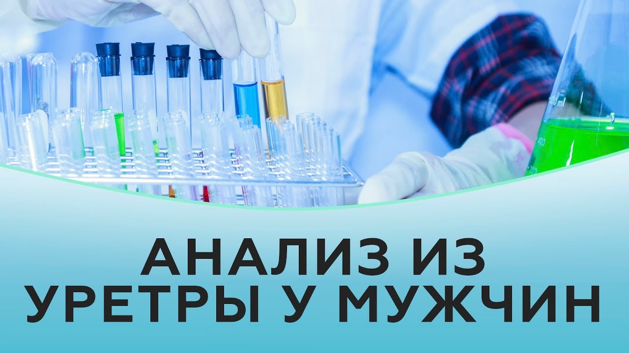 Анализ из уретры у мужчин.