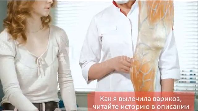 Что такое варикоз  причины возникновения