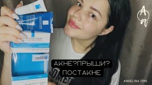 ЧИСТАЯ КОЖА БЕЗ АКНЕ И ВЫСЫПАНИЙ ДОМА. LA ROCHE POSAY