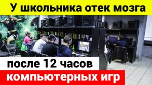 Школьник играл в компьютер 12 часов и получил отек мозга