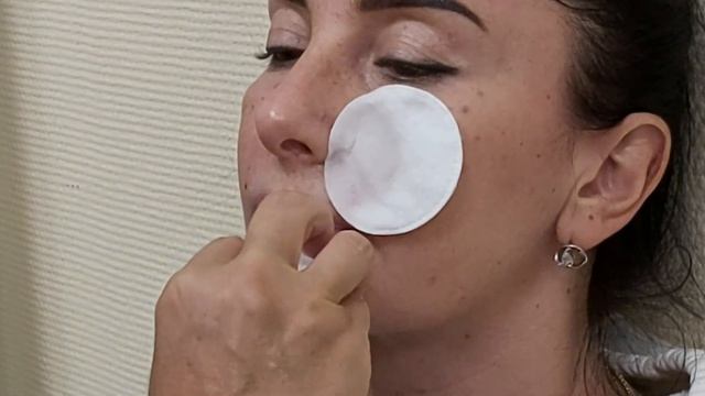 АирисКом студенты учатся: практические занятия по заполнению морщин подбородка плотным филлером.