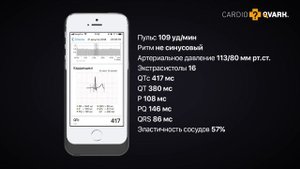 CardioQVARK - кардиограмма и артериальное давление в телефоне