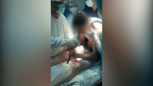 Стальная арматура вонзилась в рот парню при ДТП в Карагандинской области, постра