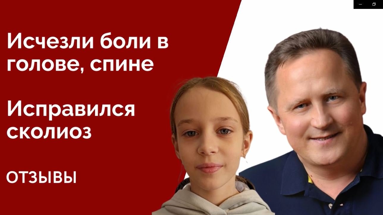 Как вылечить сколиоз у детей навсегда. Отзывы детей о процедуре коррекции атланта