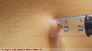 Как ПРАВИЛЬНО достать/вынуть клеща и все ли клещи опасны? How CORRECT to get a tick?