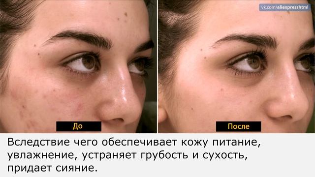 Крем для лица с экстрактом королевской улитки с Алиэкспресс смотреть онлайн