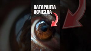 Как я катаракту укропом вылечила. Рецепт очень простой