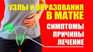 Киста Узлы Миома Матки и Рак. Симптомы Причины Лечение