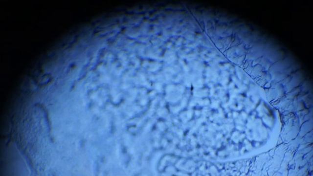 Засохший белок куриного яйца под микроскопом смотреть онлайн