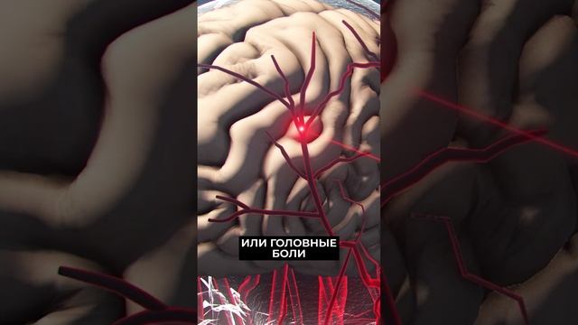 ?Слабость и быстрая утомляемость — симптомы нехватки железа в организме #новости #рекомендации