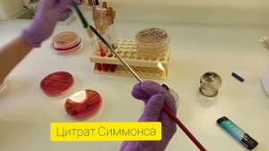 Выделение чистой культуры аэробов. 2-3 этапы