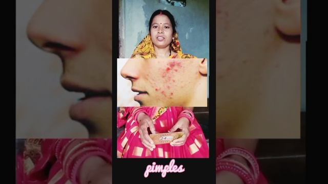 24 Carat Cream Success Results Share by Jyotsnamayee sahu Kantapada смотреть онлайн