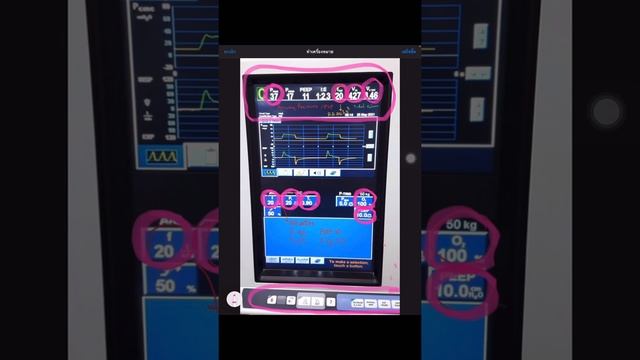 ปรับ setting Ventilator B840 แบบง่ายยยยยยยย จริง смотреть онлайн