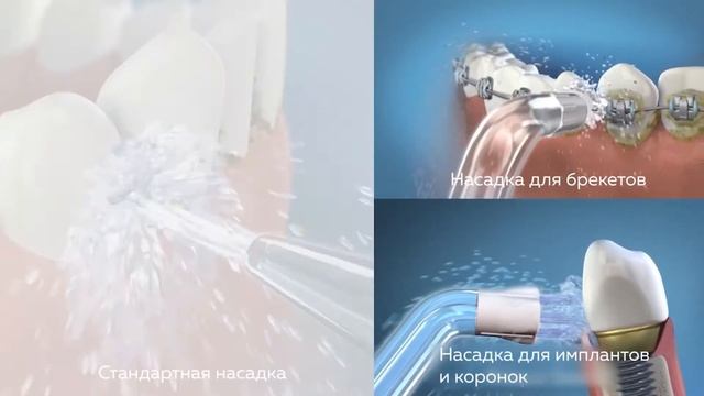 Как пользоваться портативным ирригатором Waterpik WP 562 Black смотреть онлайн