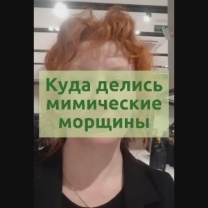 Куда делись мимические морщины. GL продукты.