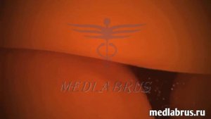 Оплодотворение- встреча сперматозоида мужчины с яйцеклеткой женщины, образуют зиготу