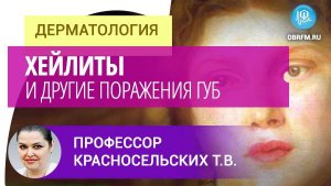 Профессор Красносельских Т.В.: Хейлиты и другие поражения губ